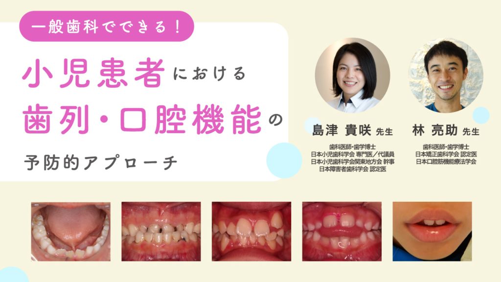 一般歯科でできる！小児患者における歯列・口腔機能の予防的アプローチ