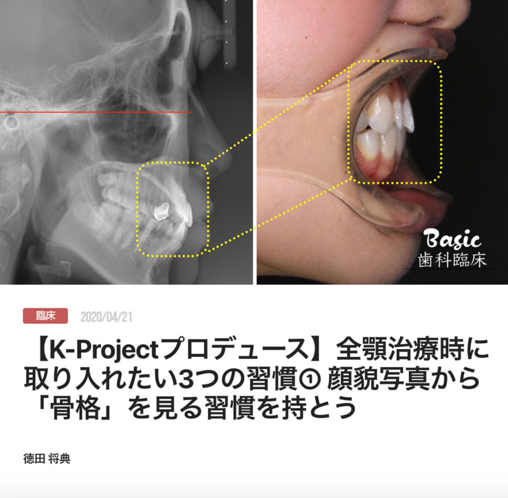 【K-Projectプロデュース】全顎治療時に取り入れたい3つの習慣① 顔貌写真から「骨格」を見る習慣を持とう
