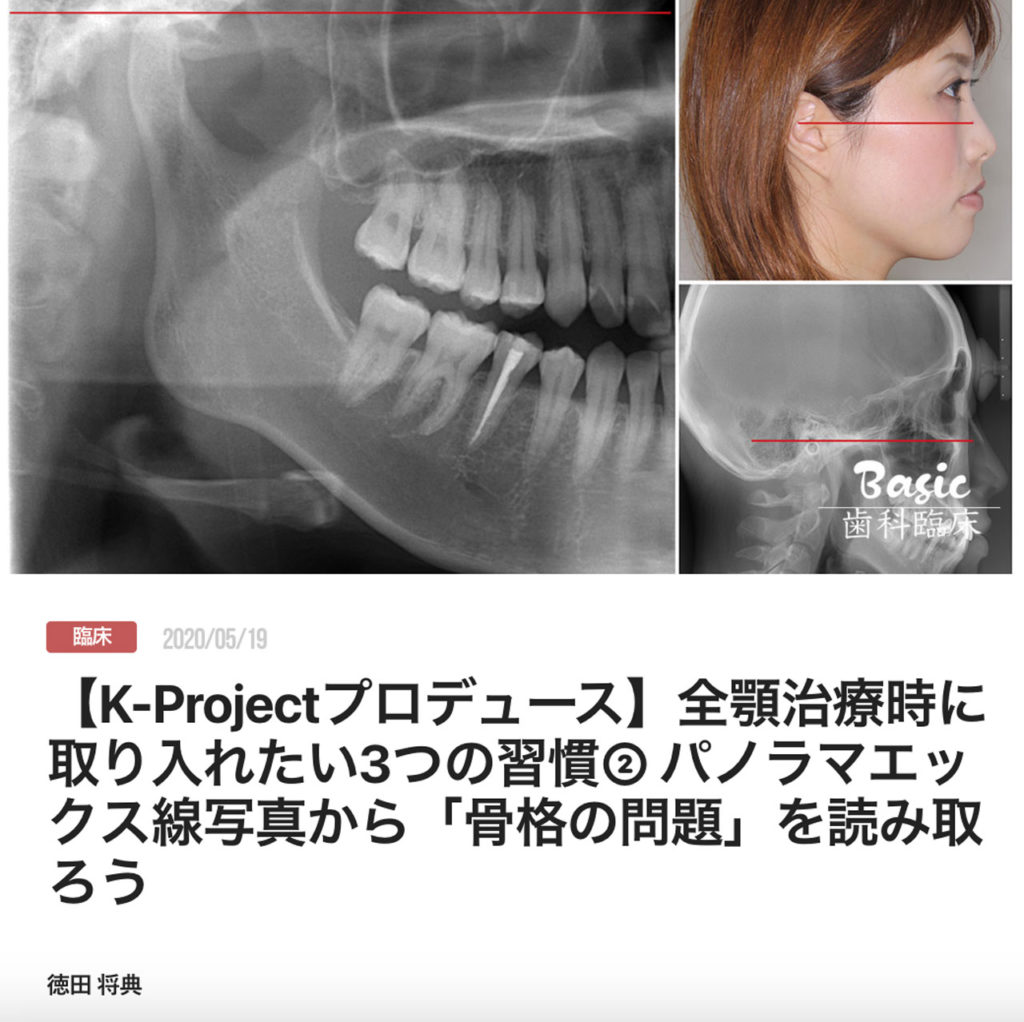 【K-Projectプロデュース】全顎治療時に取り入れたい3つの習慣② パノラマエックス線写真から「骨格の問題」を読み取ろう