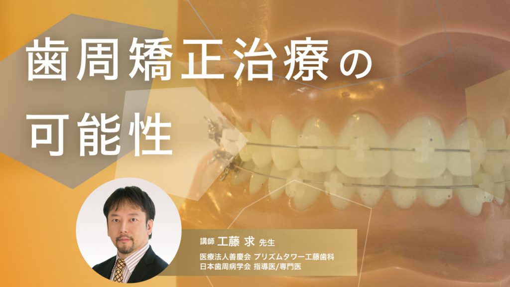 歯周矯正治療の可能性