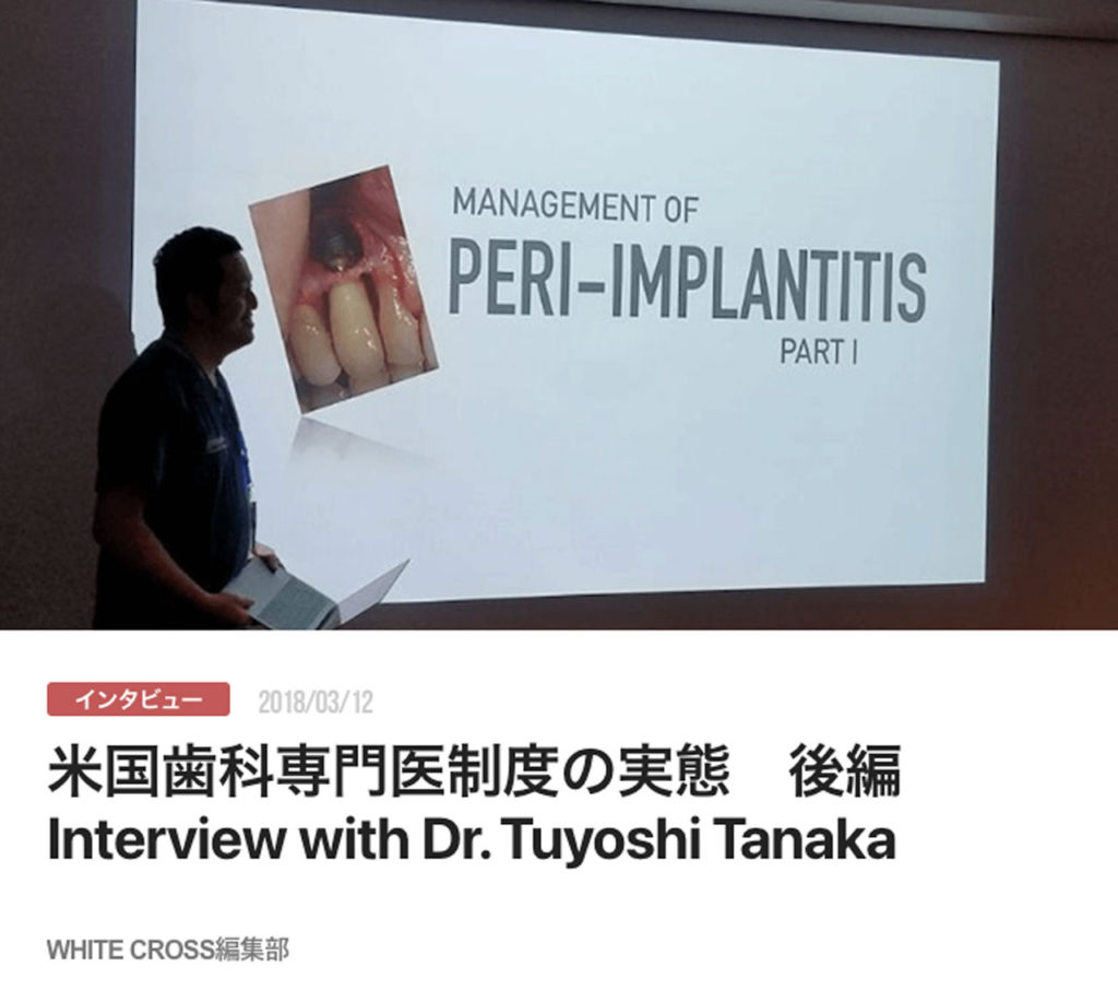 米国歯科専門医制度の実態　後編　Interview with Dr. Tuyoshi Tanaka