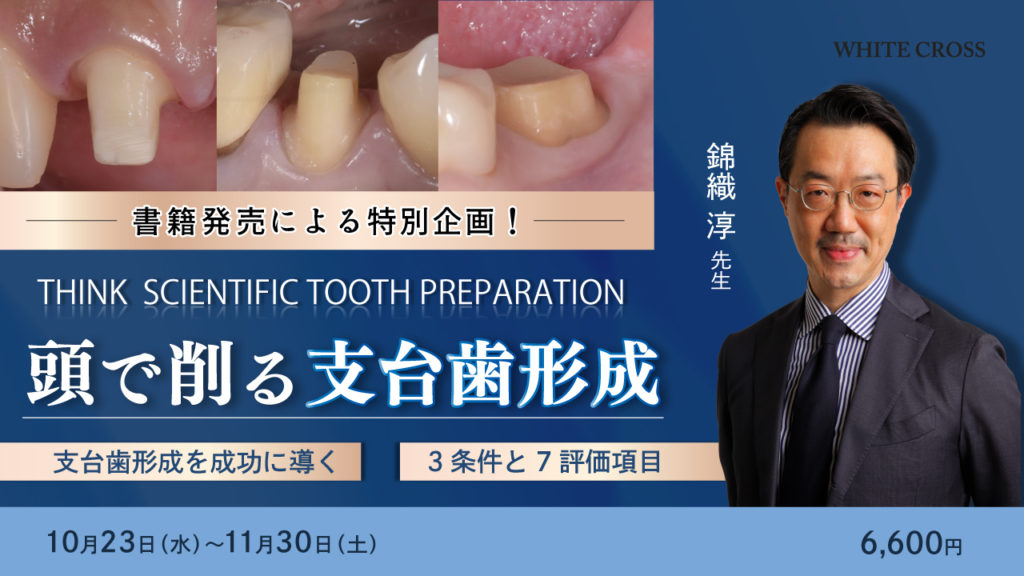 THINK SCIENTIFIC TOOTH PREPARATION 頭で削る支台歯形成～支台歯形成を成功に導く3条件と7評価項目〜