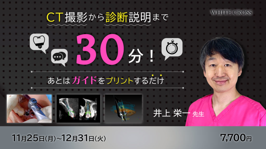 CT撮影から診断説明まで30分！あとはガイドをプリントするだけ