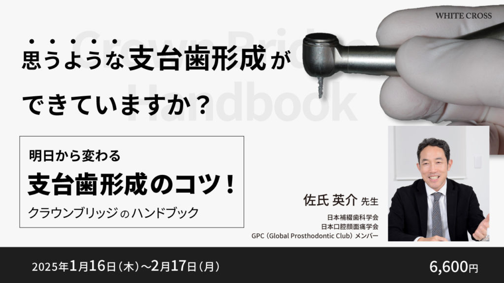 明日から変わる支台歯形成のコツ！クラウンブリッジのハンドブック