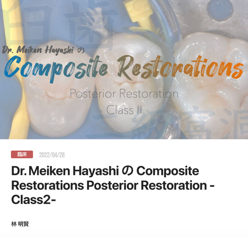 Dr. Meiken Hayashi の Composite Restorations Posterior Restoration -Class2-