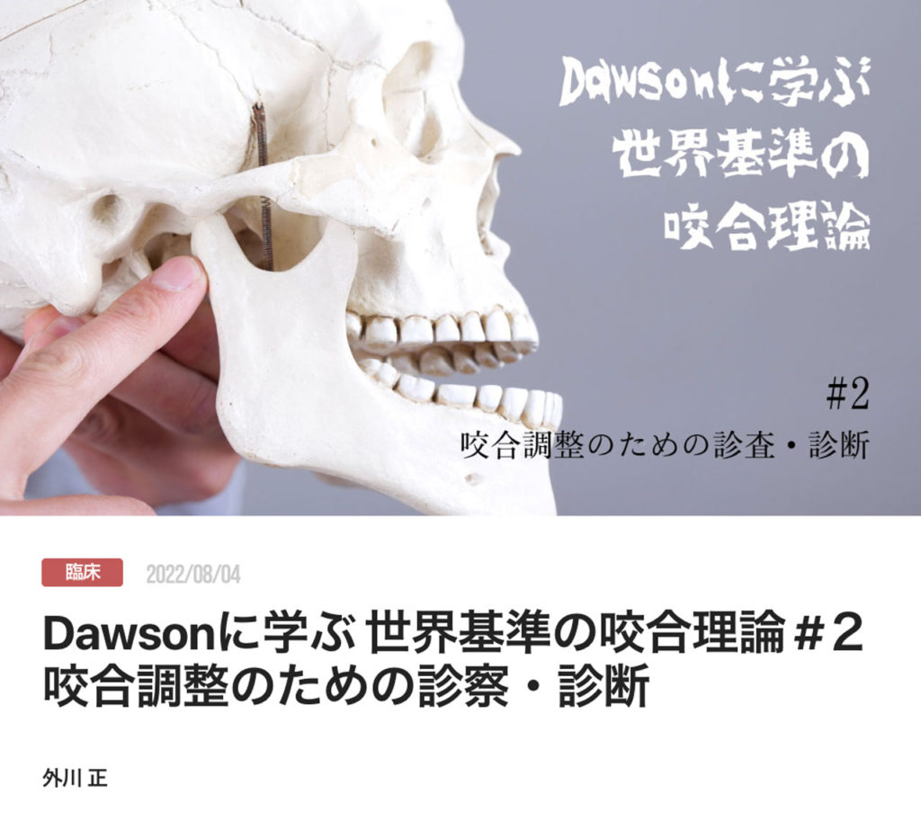 Dawsonに学ぶ 世界基準の咬合理論 #２ 咬合調整のための診察・診断