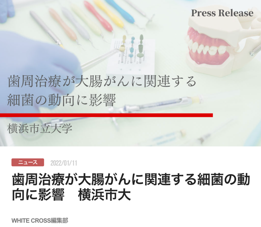 歯周治療が大腸がんに関連する細菌の動向に影響　横浜市大
