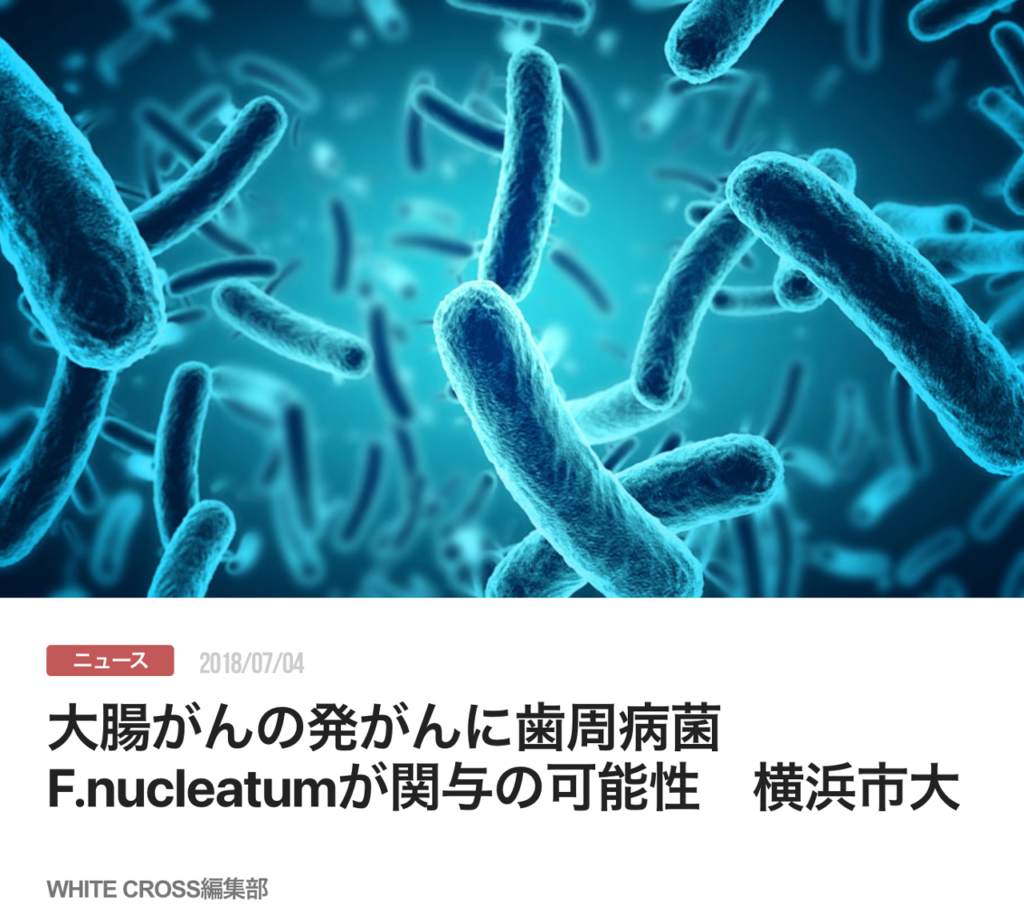 大腸がんの発がんに歯周病菌F.nucleatumが関与の可能性　横浜市大