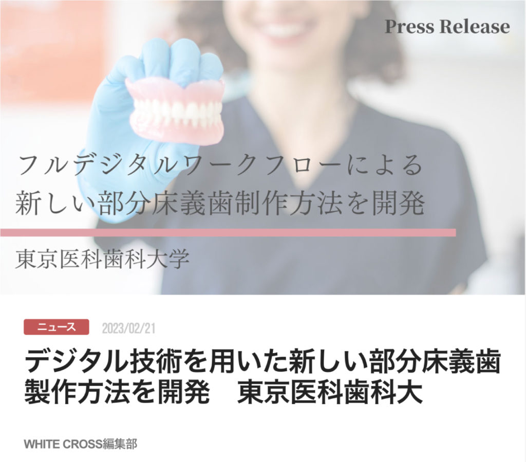 デジタル技術を用いた新しい部分床義歯製作方法を開発　東京医科歯科大