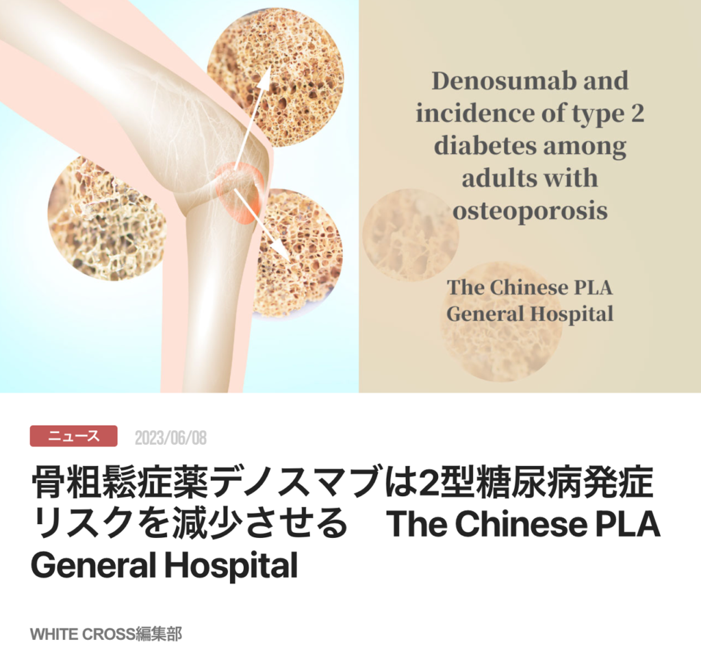 骨粗鬆症薬デノスマブは2型糖尿病発症リスクを減少させる　The Chinese PLA General Hospital
