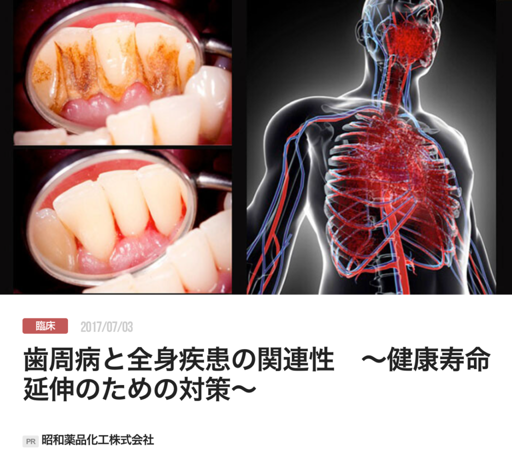 歯周病と全身疾患の関連性　〜健康寿命延伸のための対策〜