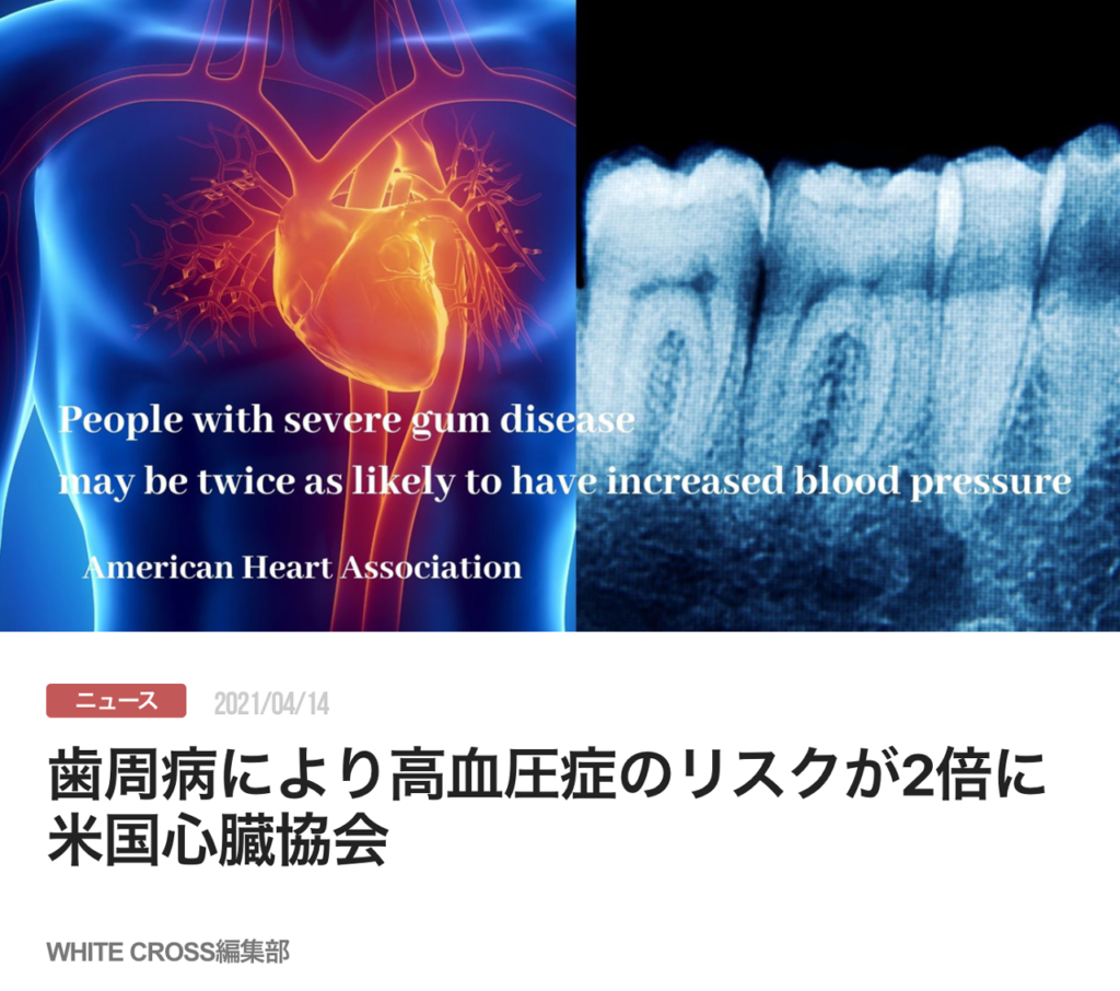 歯周病により高血圧症のリスクが2倍に　米国心臓協会