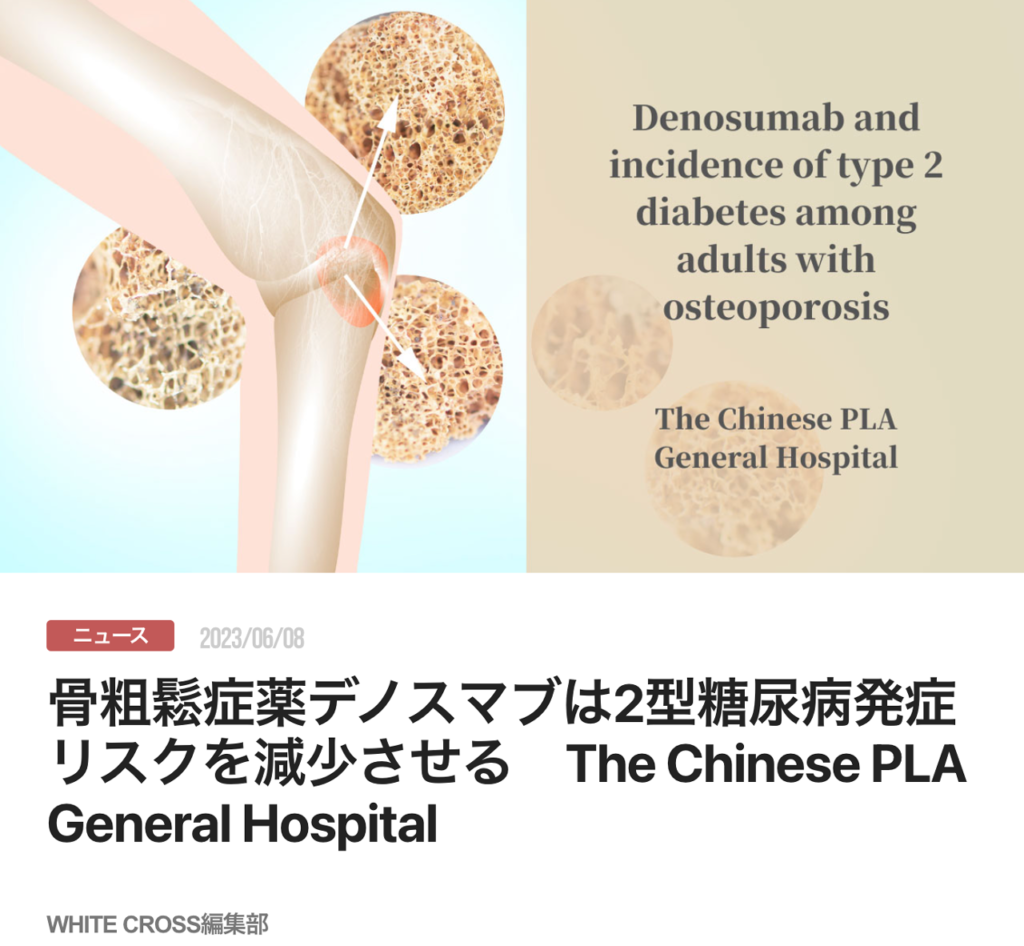 骨粗鬆症薬デノスマブは2型糖尿病発症リスクを減少させる　The Chinese PLA General Hospital