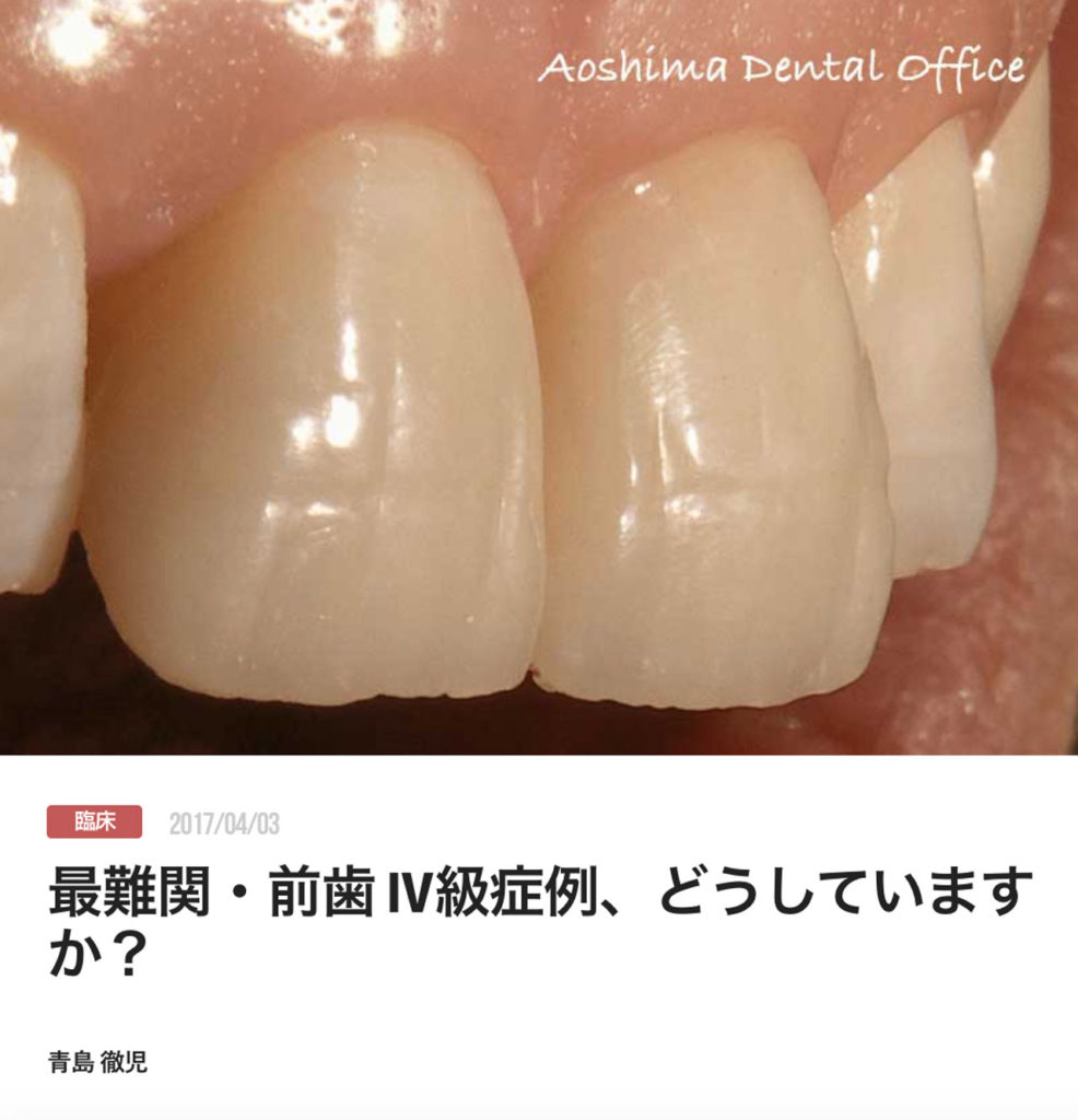 最難関・前歯 Ⅳ級症例、どうしていますか？