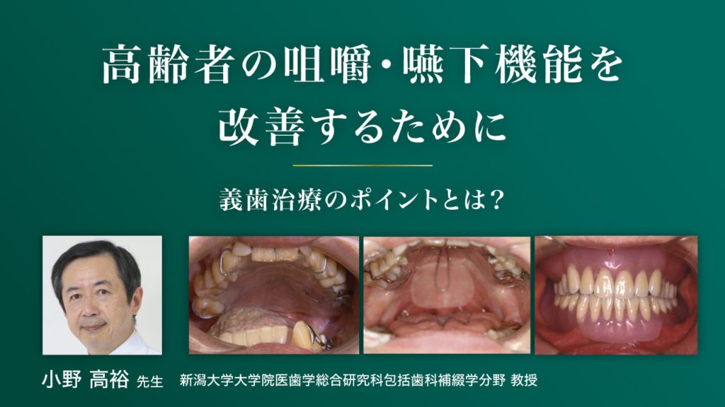 高齢者の咀嚼・嚥下機能を改善するために ー義歯治療のポイントとは？ー