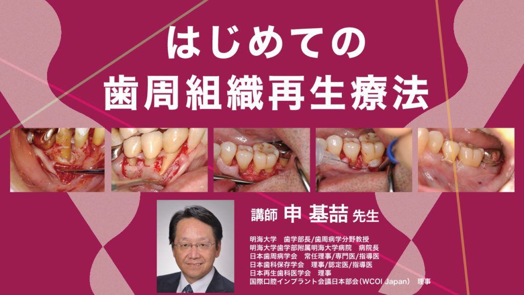 はじめての歯周組織再生療法
