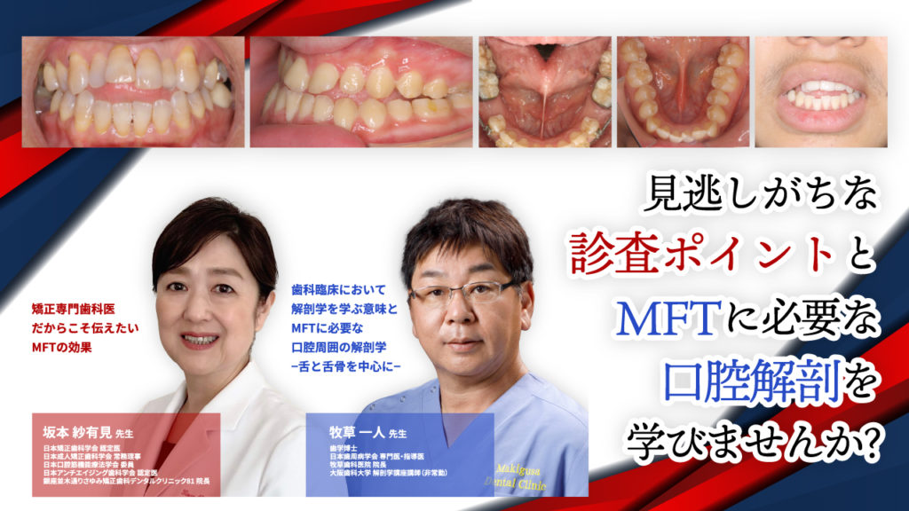 見逃しがちな診査ポイントとMFTに必要な口腔解剖を学びませんか？