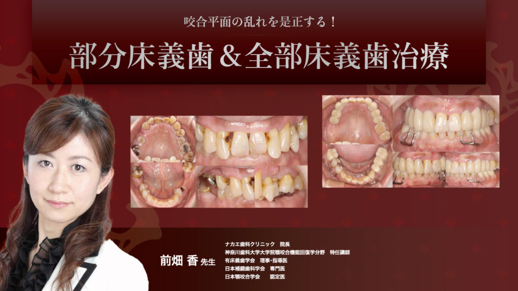 咬合平面の乱れを是正する！部分床義歯＆全部床義歯治療