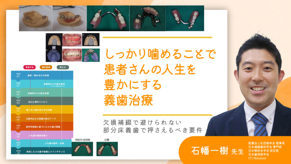 しっかり噛めることで患者さんの人生を豊かにする義歯治療〜欠損補綴で避けられない部分床義歯で押さえるべき要件〜