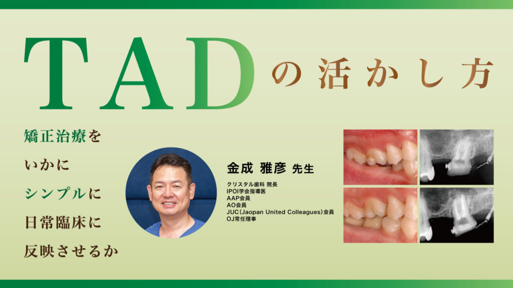 TADの活かし方〜矯正治療をいかにシンプルに日常臨床に反映させるか〜