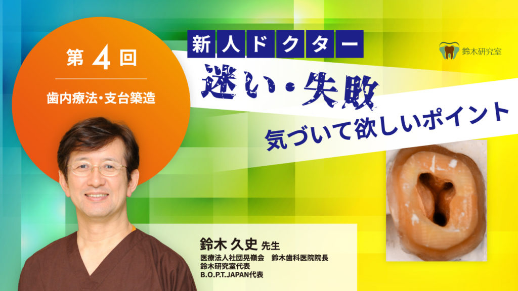 歯内療法・支台築造〜第4回 新人ドクター 迷い・失敗 気づいて欲しいポイント〜