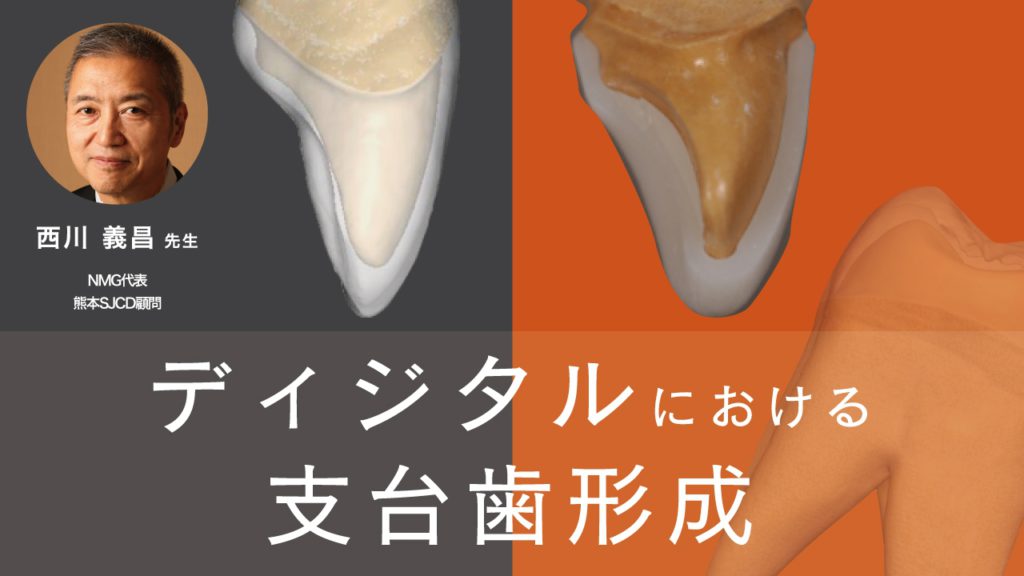 ディジタルにおける支台歯形成
