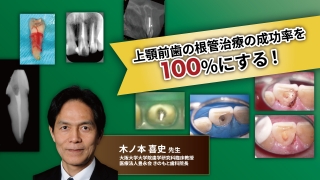 上顎前歯の根管治療の成功率を100%にする！