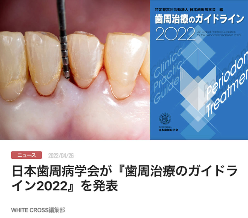 日本歯周病学会が『歯周治療のガイドライン2022』を発表