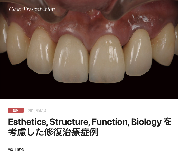 Esthetics, Structure, Function, Biology を考慮した修復治療症例