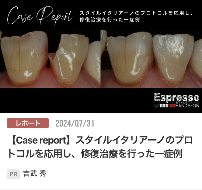 【Case report】スタイルイタリアーノのプロトコルを応用し、修復治療を行った一症例
