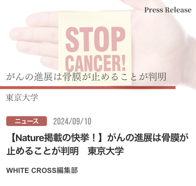 【Nature掲載の快挙！】がんの進展は骨膜が止めることが判明　東京大学