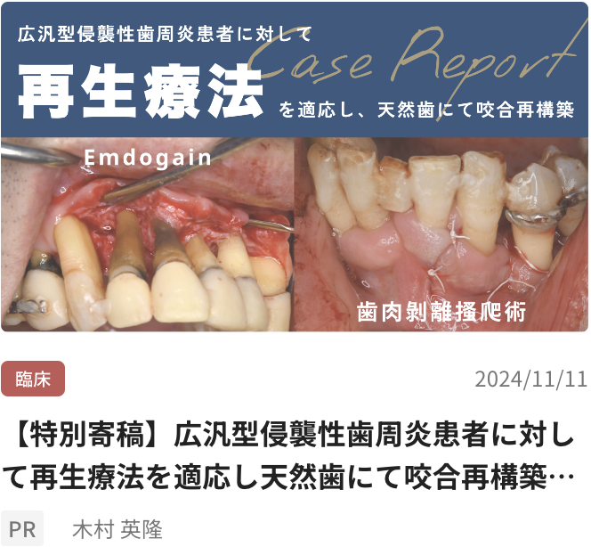 【特別寄稿】広汎型侵襲性歯周炎患者に対して再生療法を適応し天然歯にて咬合再構築を行った一症例