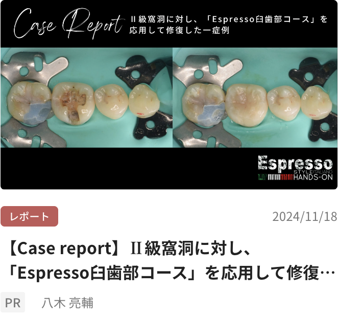 【Case report】Ⅱ級窩洞に対し、「Espresso臼歯部コース」を応用して修復した一症例