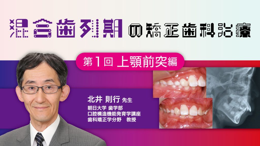 混合歯列期の矯正歯科治療　第1回　上顎前突編