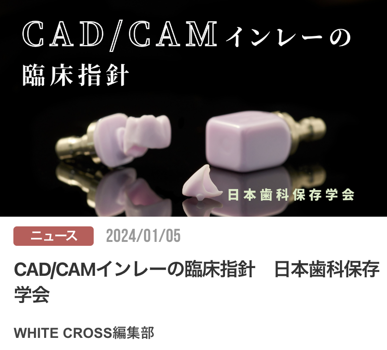 CAD/CAMインレーの臨床指針　日本歯科保存学会