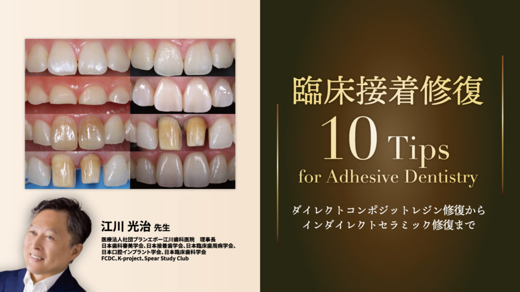 臨床接着修復10Tips for Adhesive Dentistry〜ダイレクトコンポジットレジン修復からインダイレクトセラミック修復まで〜