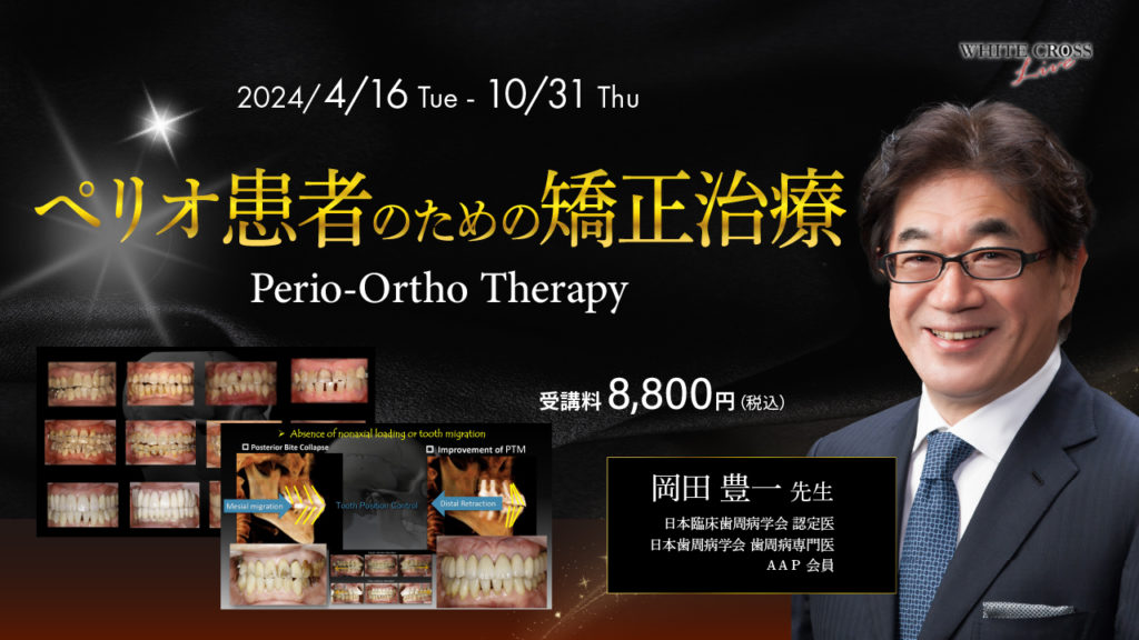 ペリオ患者のための矯正治療（Perio-Ortho Therapy）