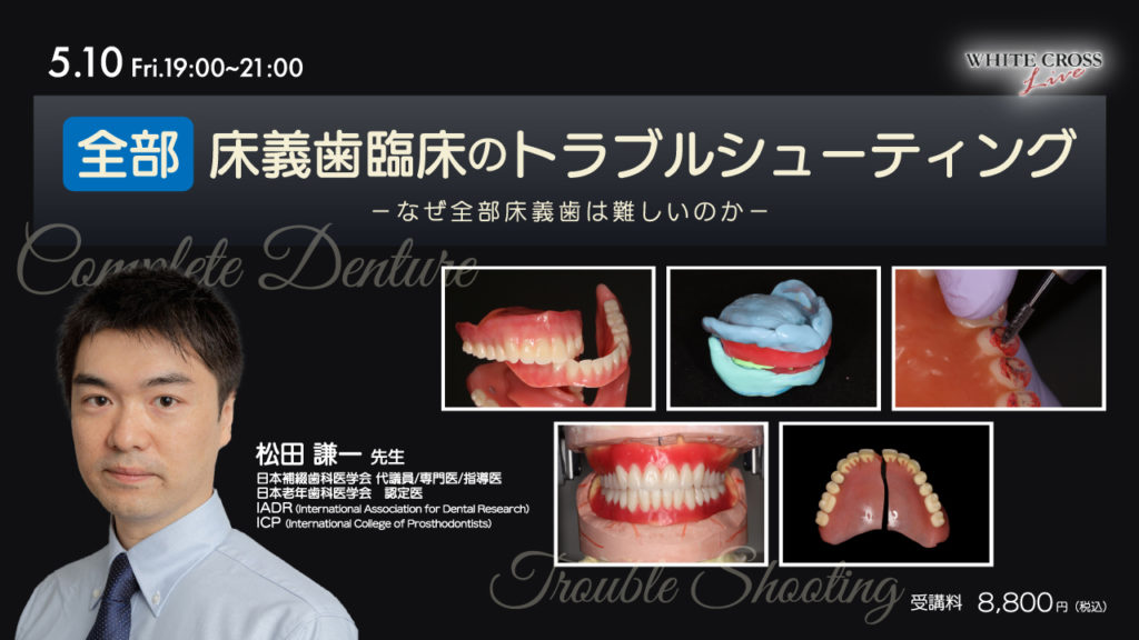 全部床義歯臨床のトラブルシューティング〜なぜ全部床義歯は難しいのか〜