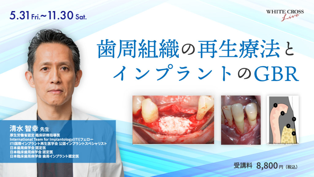 歯周組織の再生療法とインプラントのGBR