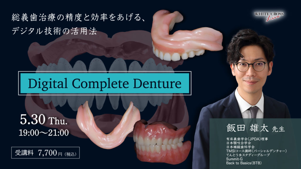 Digital Complete Denture〜総義歯治療の精度と効率をあげる、デジタル技術の活用法〜