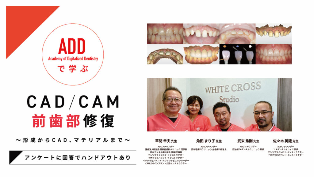 ADDで学ぶ CAD/CAM前歯部修復〜形成からCAD、マテリアルまで〜