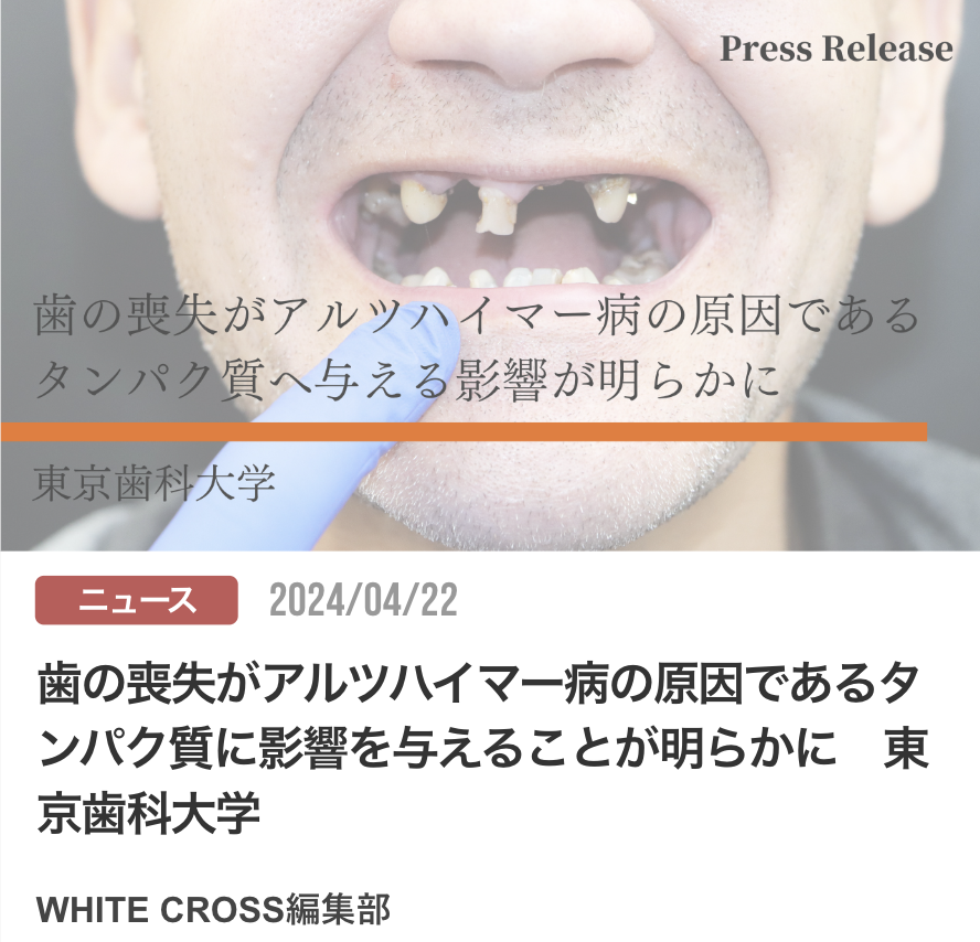 歯の喪失がアルツハイマー病の原因であるタンパク質に影響を与えることが明らかに　東京歯科大学