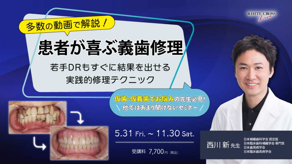 多数の動画で解説！患者が喜ぶ義歯修理〜若手DRもすぐに結果を出せる実践的修理テクニック〜