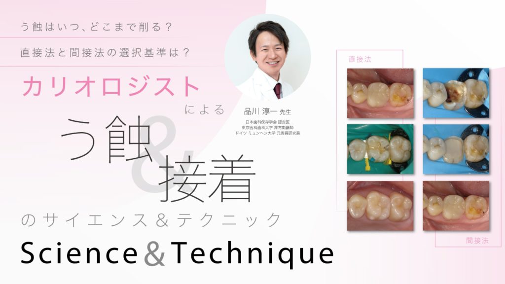 カリオロジストによるう蝕&接着のscience & technique