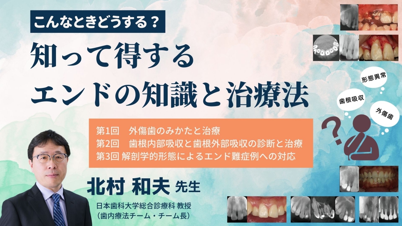 こんなときどうする？ 知って得するエンドの知識と治療法