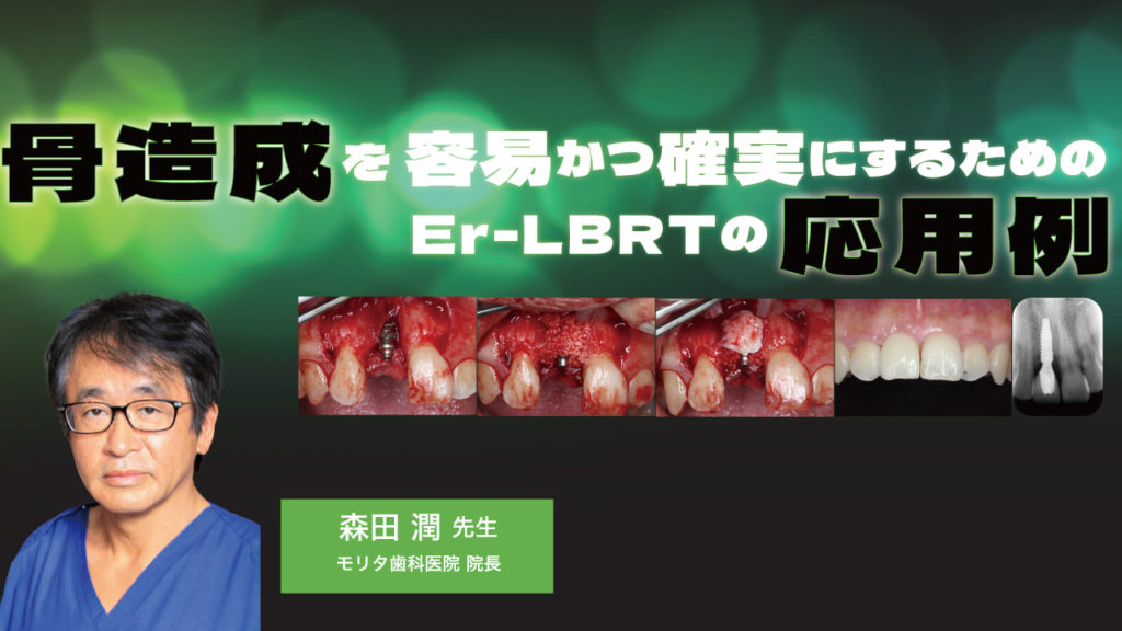骨造成を容易かつ確実にするためのEr-LBRTの応用例