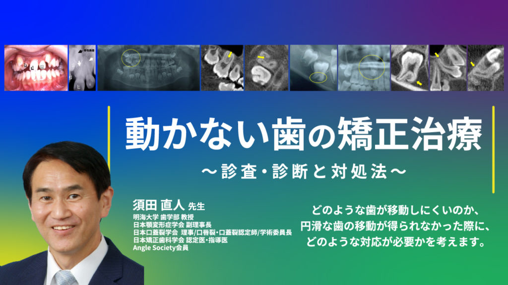 動かない歯の矯正治療〜診査・診断と対処法〜