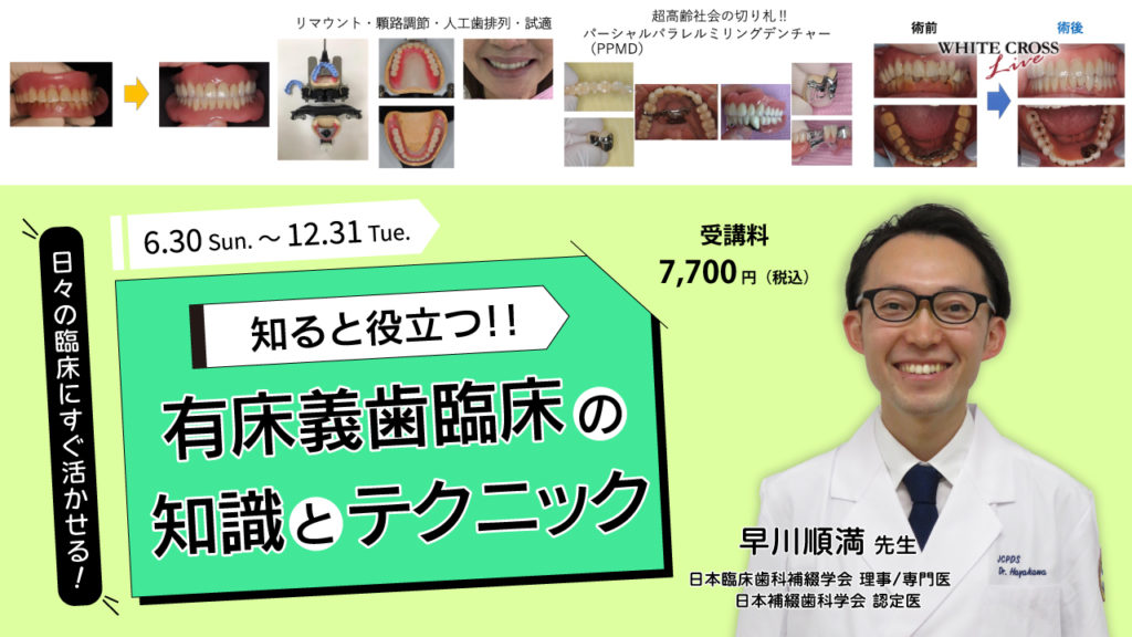 知ると役立つ！！有床義歯臨床の知識とテクニック