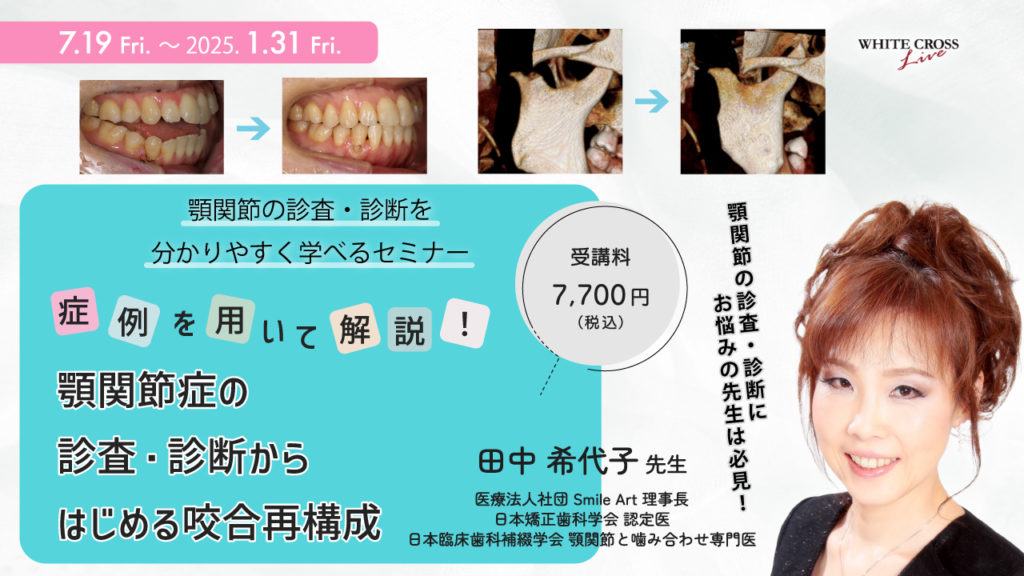 症例を用いて解説！顎関節症の診査・診断からはじめる咬合再構成