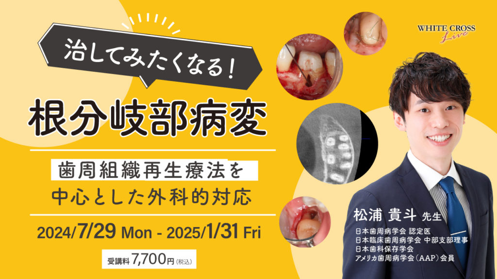 治してみたくなる！根分岐部病変〜歯周組織再生療法を中心とした外科的対応〜